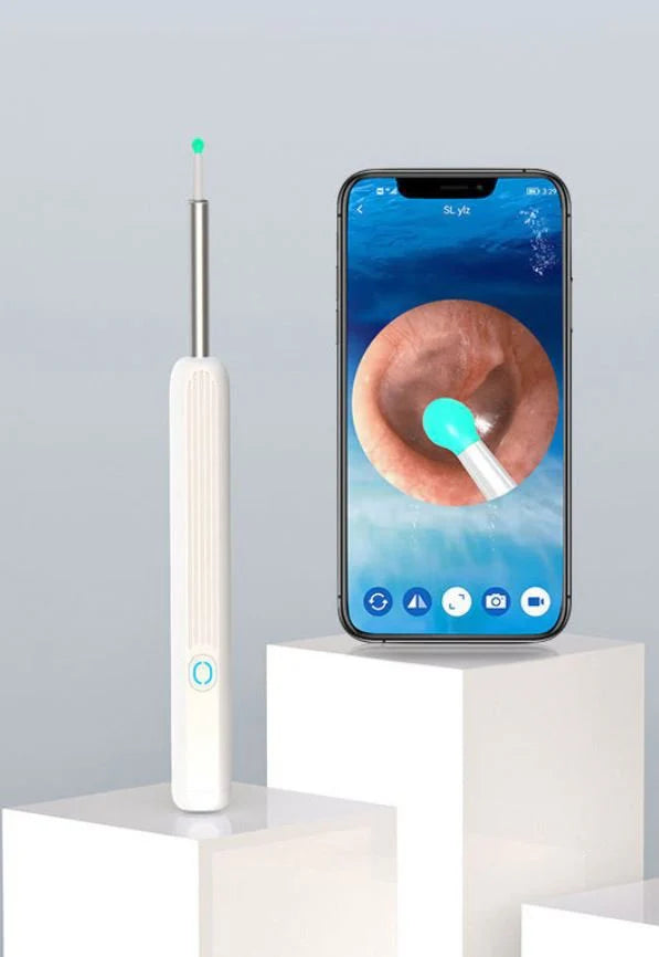 Smart Visual Earwax Removal Kit – See & Clean Safely at Home 👂📱
